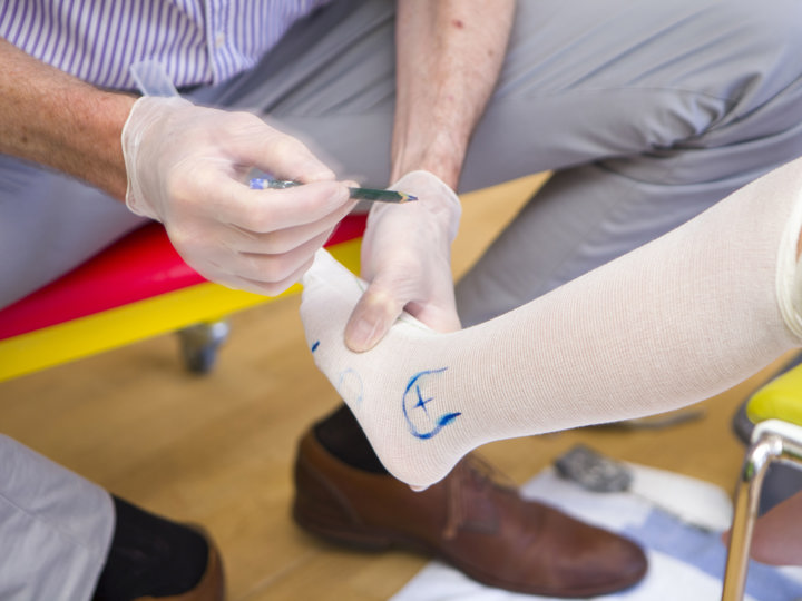 Child getting a fixed ankle foot orthosis